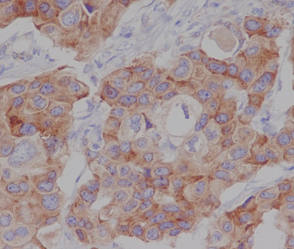 Anti-Phospho-mTOR (Ser2448) Rabbit pAb