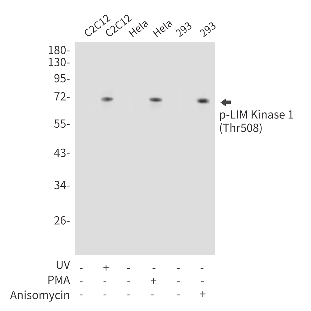 Anti-Phospho-LIM Kinase 1 (Thr508) Rabbit pAb