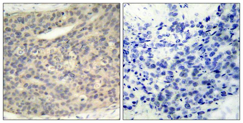 Anti-Phospho-LIM Kinase 1 (Thr508) Rabbit pAb