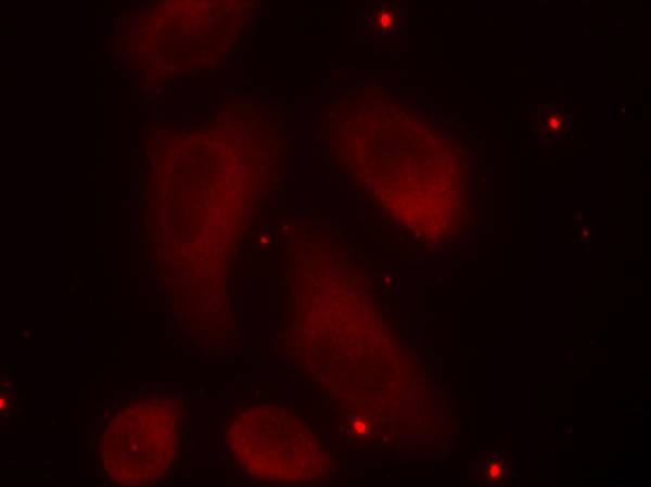 Anti-Phospho-LIM Kinase 1 (Thr508) Rabbit pAb