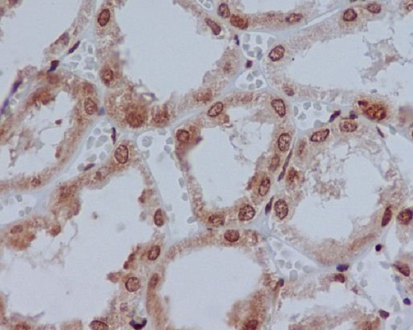 Anti-YB1 Rabbit pAb