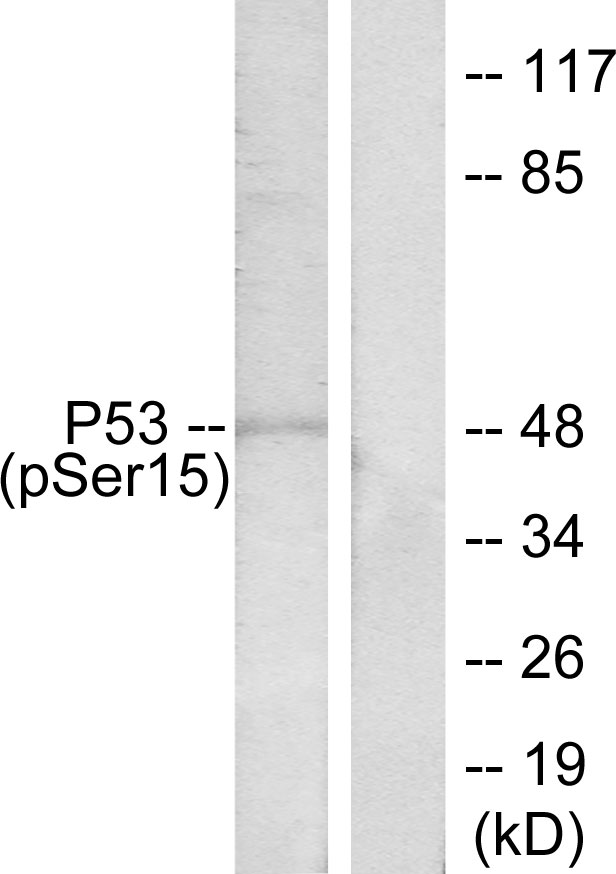 Anti-Phospho-p53 (Ser15) Rabbit pAb