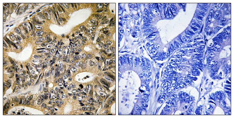Anti-Phospho-4E-BP1 (Thr70) Rabbit pAb