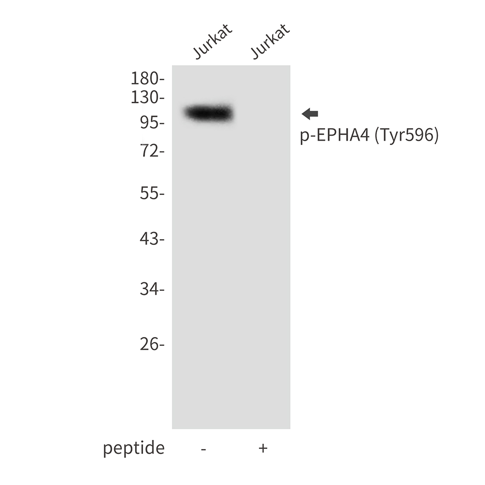 Anti-Phospho-EPHA4 (Tyr596) Rabbit pAb