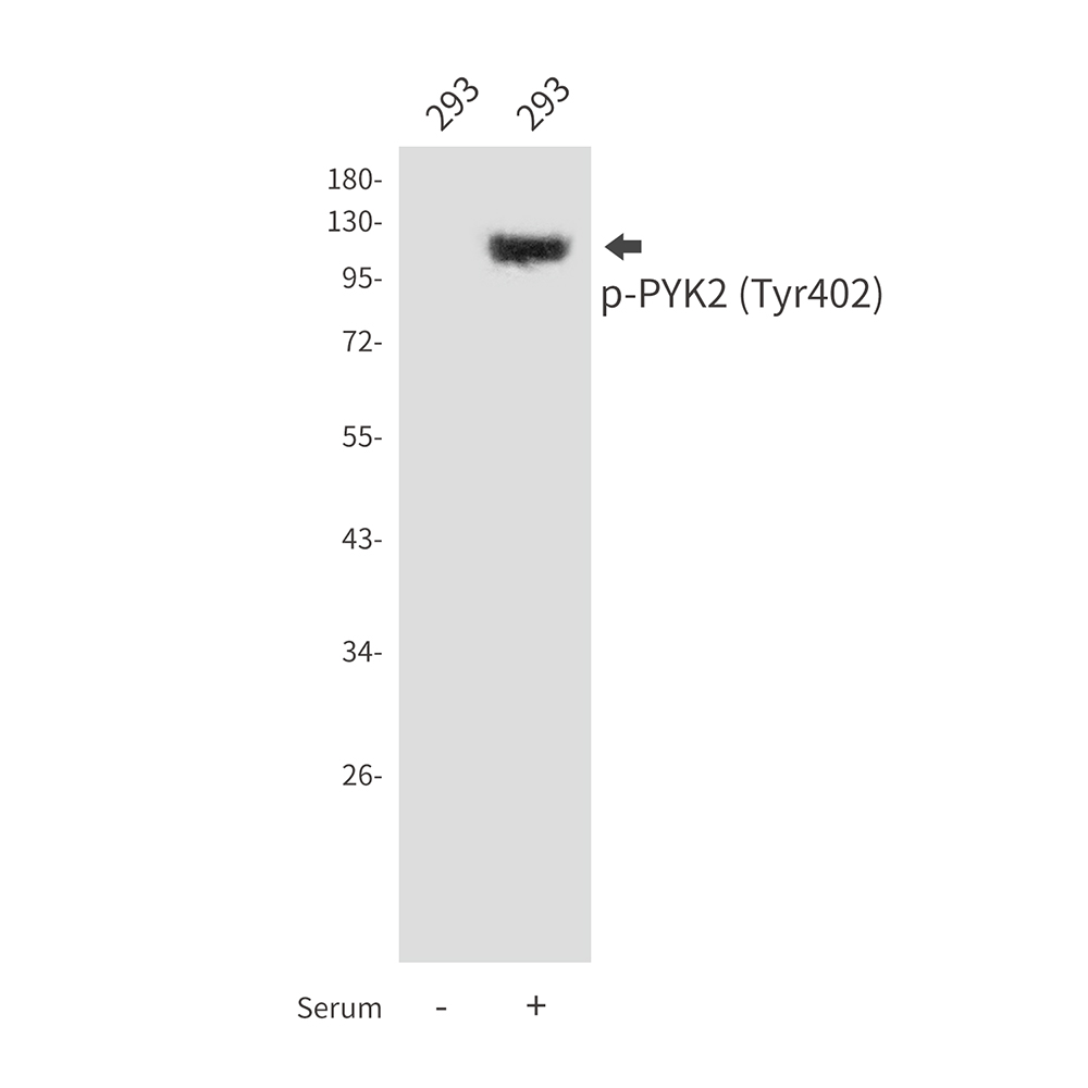 Anti-Phospho-PYK2 (Tyr402) Rabbit pAb