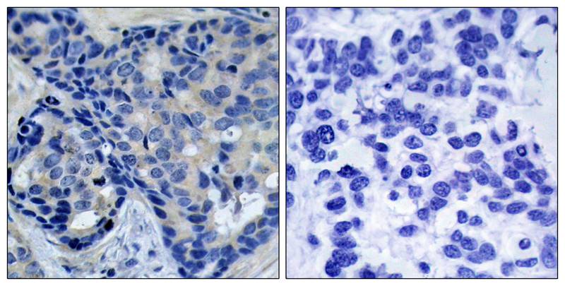 Anti-Phospho-PYK2 (Tyr402) Rabbit pAb
