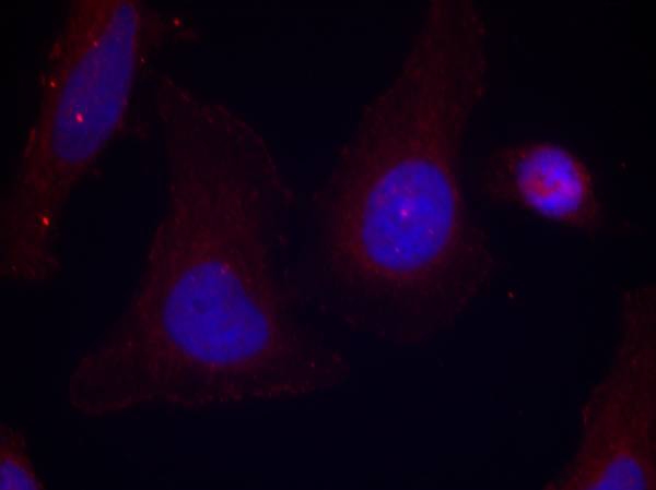 Anti-Phospho-PYK2 (Tyr402) Rabbit pAb