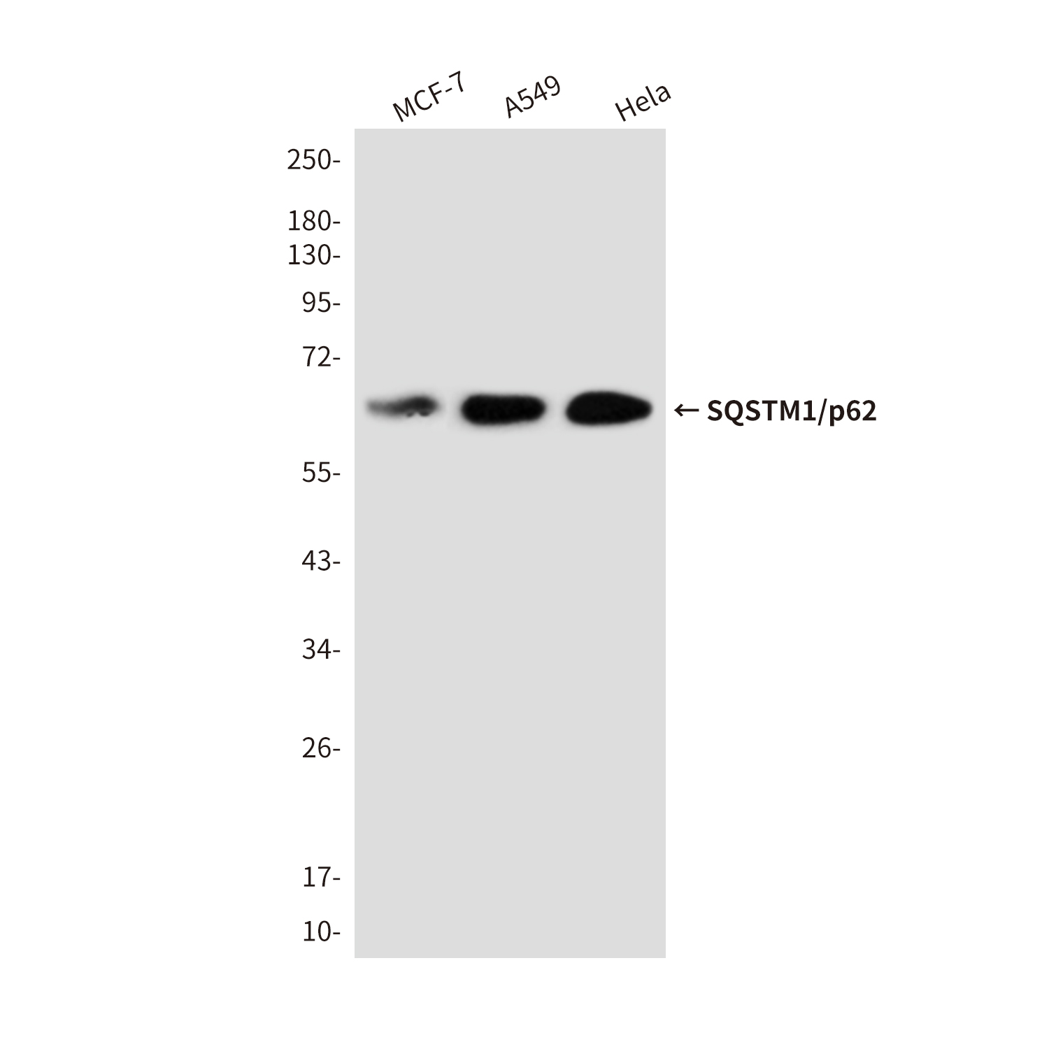 Anti-SQSTM1/p62 Rabbit pAb
