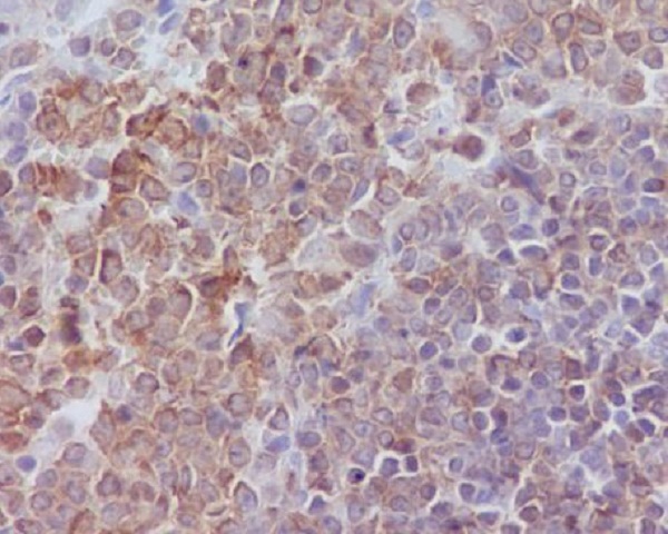 Anti-SHP1 Rabbit pAb