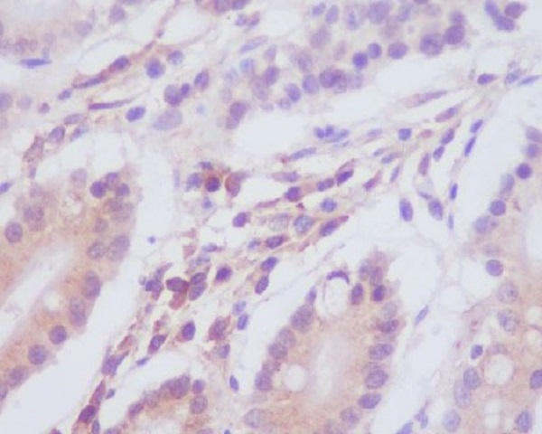 Anti-LC3A Rabbit pAb