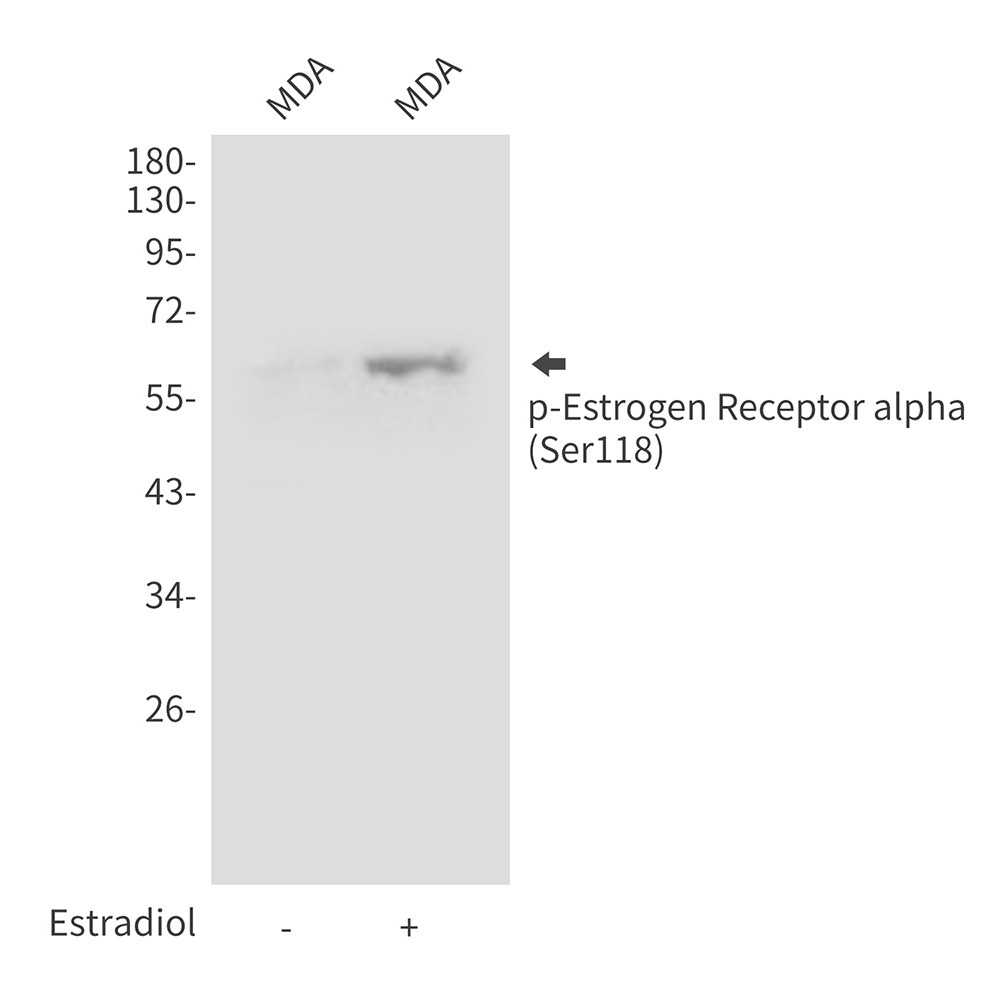 Anti-Phospho-Estrogen Receptor alpha (Ser118) Rabbit pAb