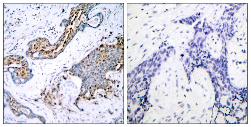 Anti-Phospho-Estrogen Receptor alpha (Ser118) Rabbit pAb