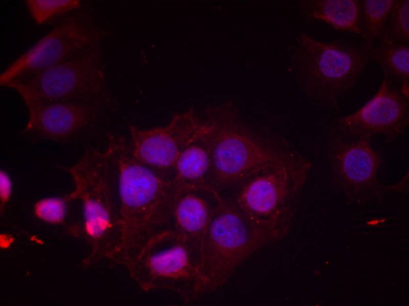 Anti-Phospho-Estrogen Receptor alpha (Ser118) Rabbit pAb