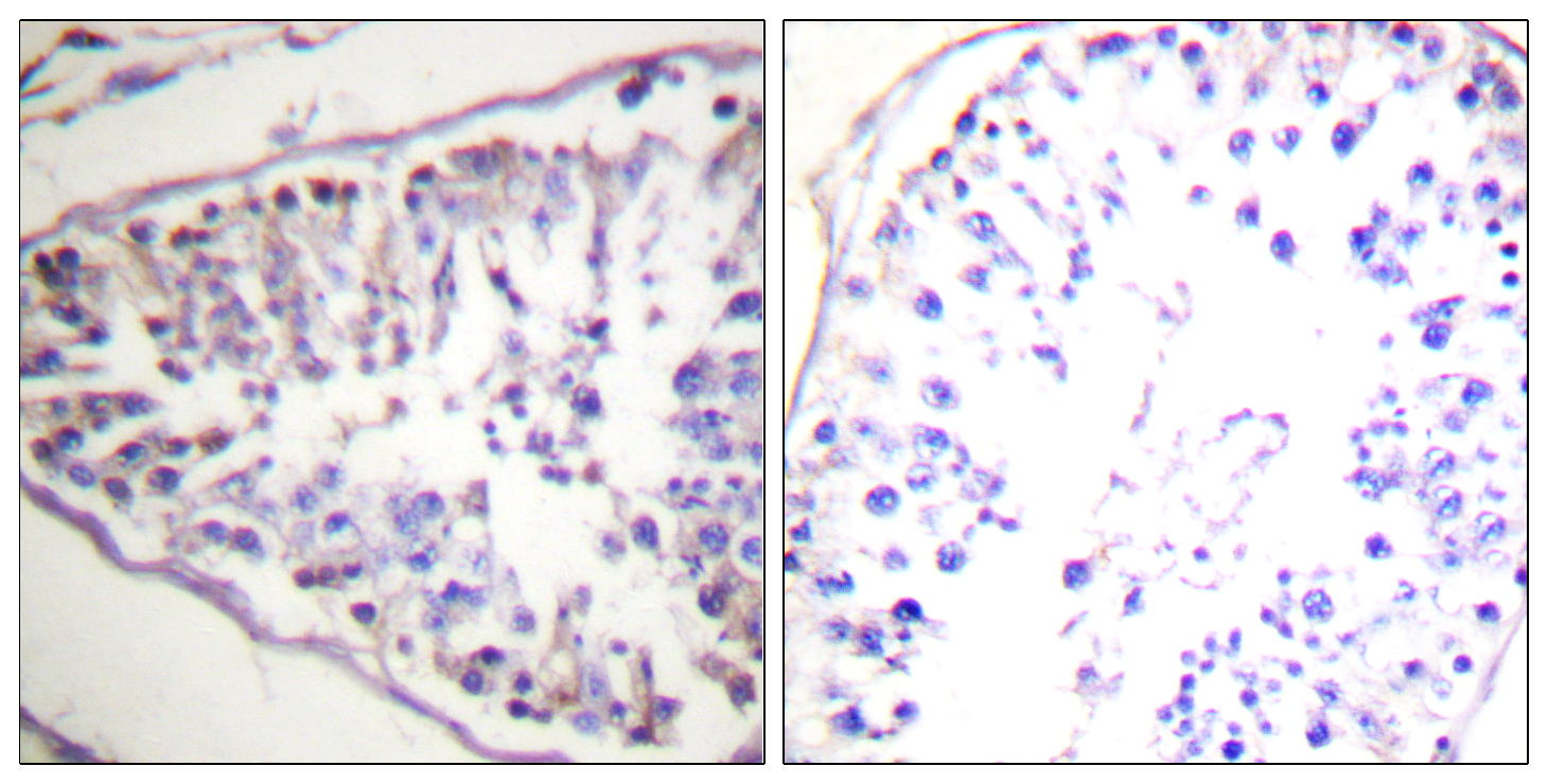 Anti-Hormone Sensitive Lipase Rabbit pAb