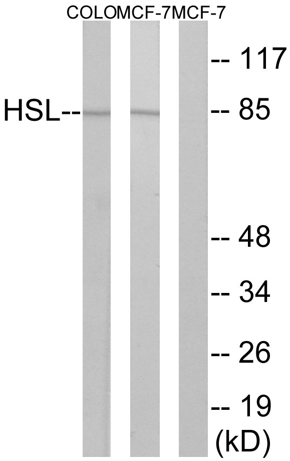 Anti-Hormone Sensitive Lipase Rabbit pAb