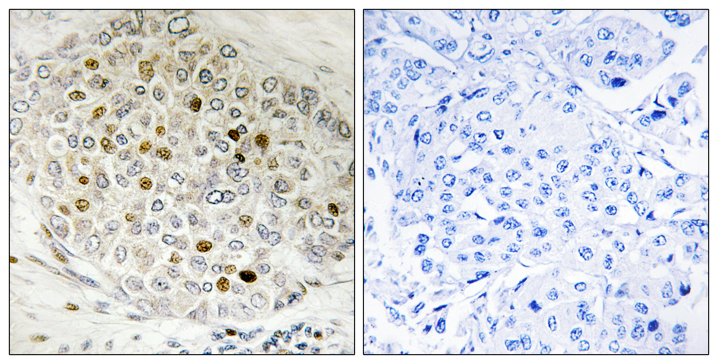 Anti-HDAC5 Rabbit pAb