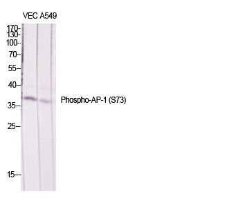 Anti-Phospho-JunD (Ser73/100) Rabbit pAb