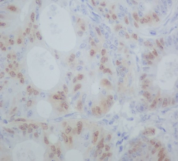 Anti-Cyclin A1/A2 Rabbit pAb
