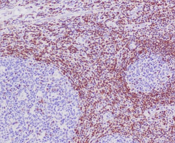Anti-Bcl2 Rabbit pAb