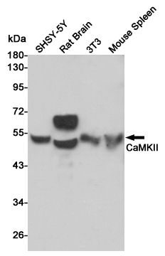 Anti-CaMKII Rabbit pAb