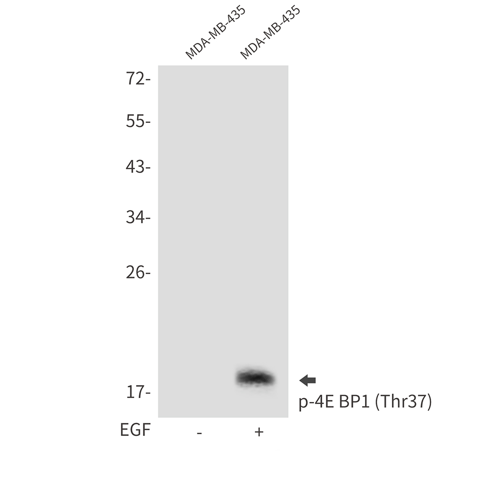 Anti-Phospho-4E-BP1 (Thr37) Rabbit pAb