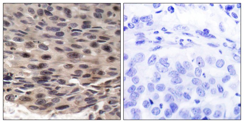 Anti-Phospho-4E-BP1 (Thr37) Rabbit pAb