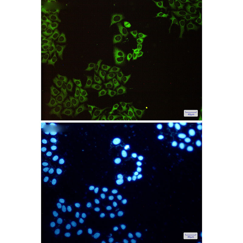 Anti-CAP1 Rabbit pAb