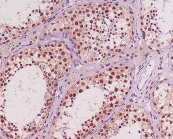 Anti-AKT Rabbit pAb