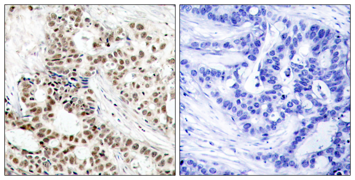 Anti-Phospho-BRCA1 (Ser1423) Rabbit pAb