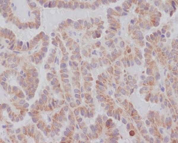 Anti-KIFC1 Rabbit pAb
