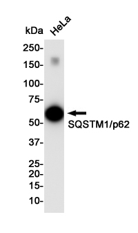 Anti-SQSTM1/p62 Rabbit pAb