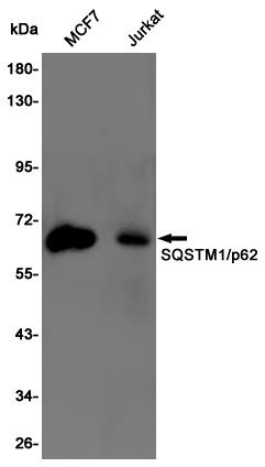 Anti-SQSTM1/p62 Rabbit pAb