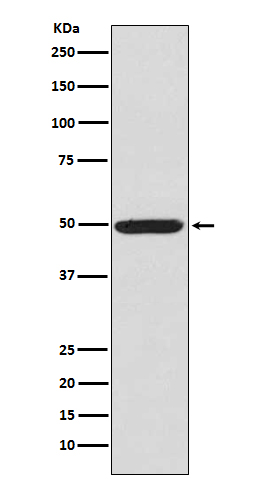 Anti-Phospho-PKA RII alpha (Ser99) Rabbit pAb