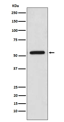 Anti-CaMKII beta Rabbit pAb