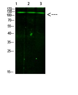Anti-Phospho-JAK2/3 (Tyr966/939) Rabbit pAb