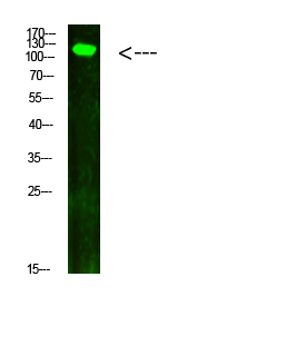 Anti-Phospho-JAK2/3 (Tyr966/939) Rabbit pAb
