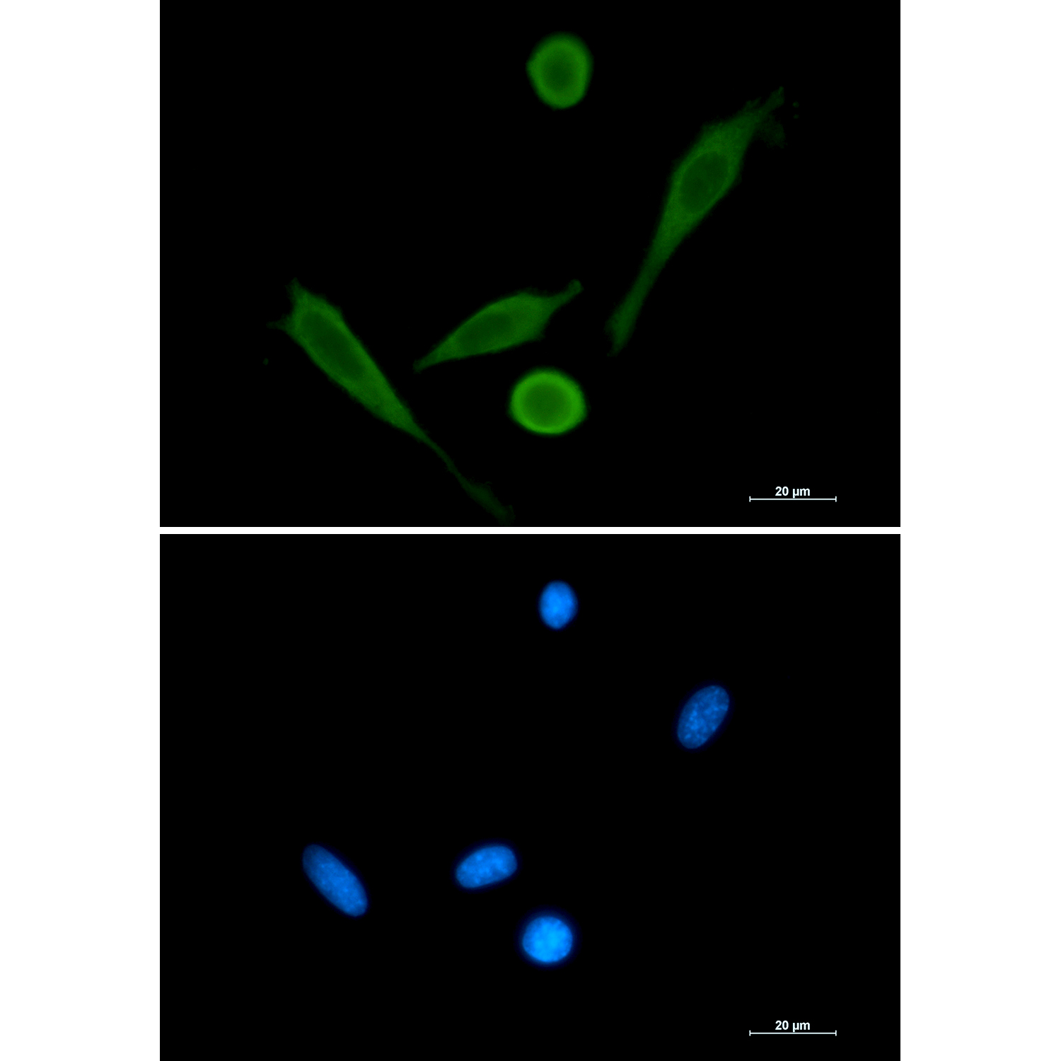 Anti-Fascin Rabbit pAb