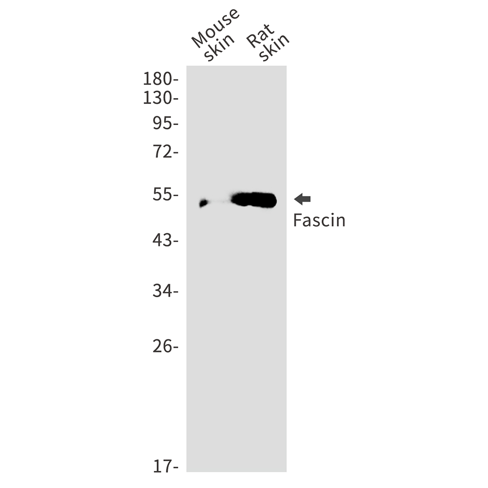 Anti-Fascin Rabbit pAb
