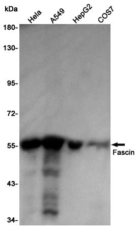 Anti-Fascin Rabbit pAb