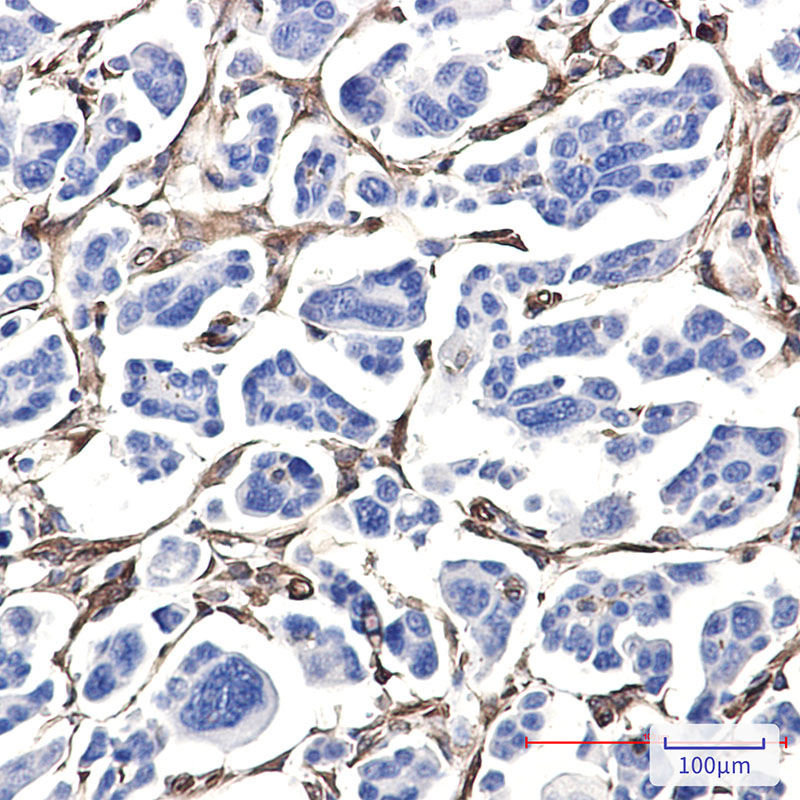 Anti-Fascin Rabbit pAb