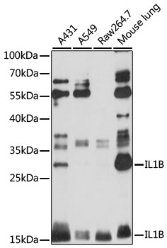 Anti-IL-1 beta Rabbit pAb