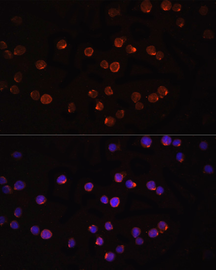 Anti-IL-1 beta Rabbit pAb