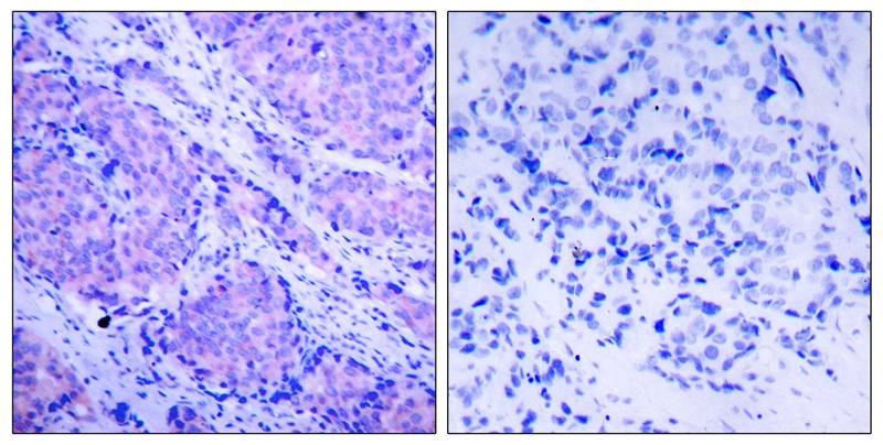 Anti-Phospho-PDPK1 (Ser241) Rabbit pAb