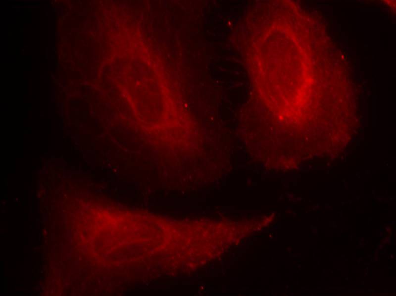Anti-Phospho-PDPK1 (Ser241) Rabbit pAb