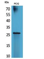 Anti-RNA Polymerase III Subunit C7 Rabbit pAb