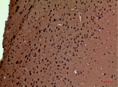 Anti-RNA Polymerase III Subunit C7 Rabbit pAb