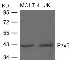 Anti-PAX5 Rabbit pAb