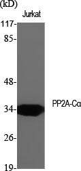 Anti-PP2A alpha Rabbit pAb