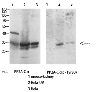 Anti-PP2A alpha Rabbit pAb