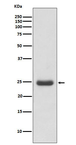 Anti-Thymidine Kinase Rabbit pAb